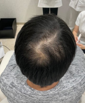 施術後
